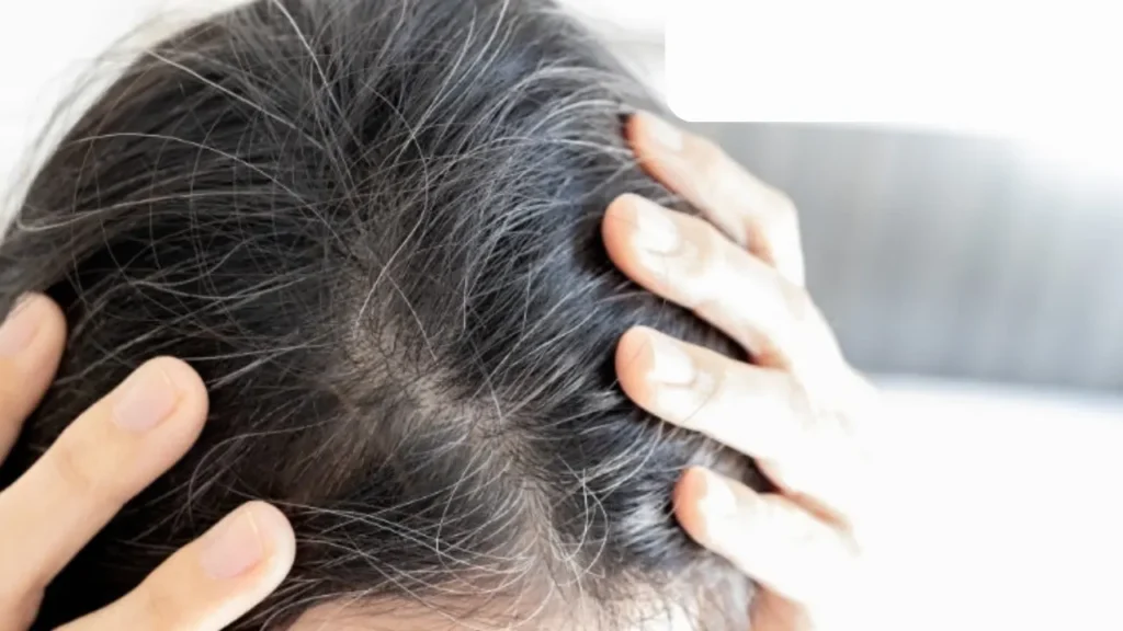 Causes of White Hair